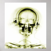 AFFISCHEN RÖNTGAR SKELETT- VITGULT FÖR MUSIK