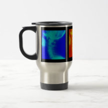 Cervical röntga Chiropractic reser kaffekoppen Kaffe Kopp