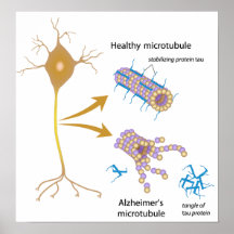 Desintegrera microtubules i Alzheimers affisch