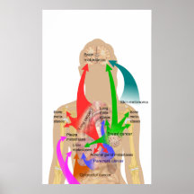 Diagram av Metastasisplatser för allmänningcancer Affischer
