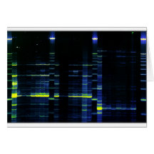 DNA ordnar gel 1 Kort