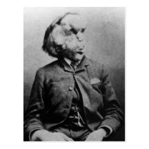 Joseph "John" Merrick elefantmanen från 1889 Vykort