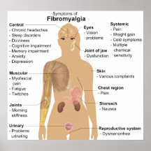 Kartlägga av tecknen av fibromyalgiaen posters