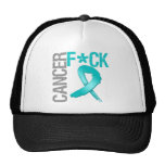 Knullcancer - Ovarian cancer Keps