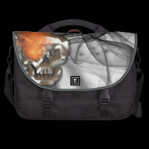 METALLSKALLE commuterbag