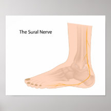 Sural nervaffisch