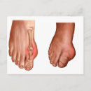 Sök efter anatomi fot Transparent