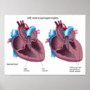 Sök efter sjukdomar konst Diagram