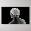 Sök efter cerebellum posters Cerebrum