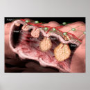Sök efter blodkärl posters Medicin