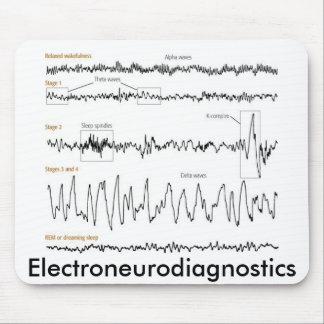 101940 Electroneurodiagnostics Musmatta