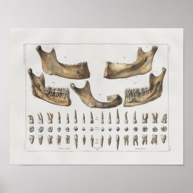 1867 Jaw Teeth Dental Vintage Anatomy Print Poster (Framsidan)