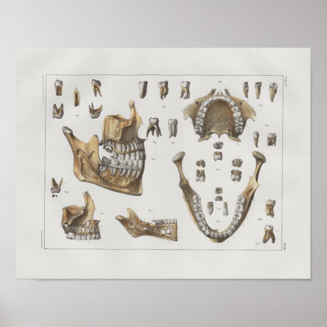 1867 Jaw Teeth Dental Vintage Anatomy Print Poster (Framsidan)