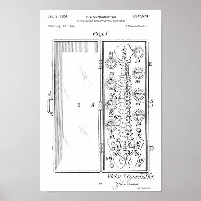 1951 Vintage Chiropraktic Spine Patent Art Print Poster (Framsidan)