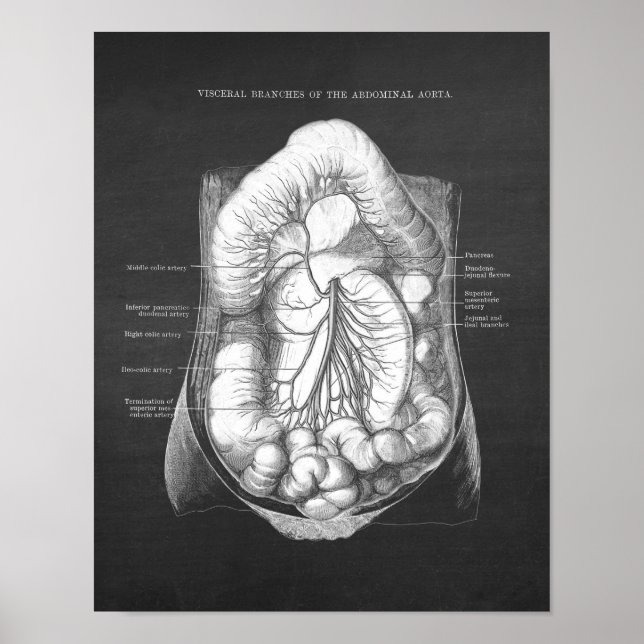 Abdominal Aorta Anatomy Poster (Framsidan)