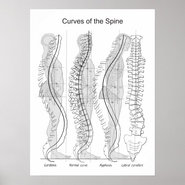 Abnormal Curves of the Spine Poster Chiropractic (Framsidan)