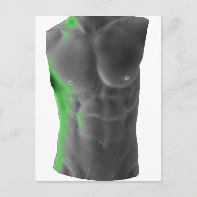 Abs Vykort (Framsida)