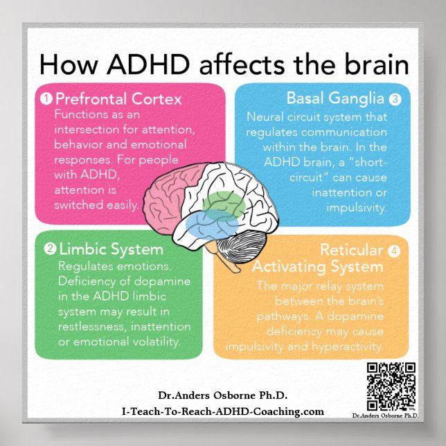 ADHD Brain* Poster (Framsidan)