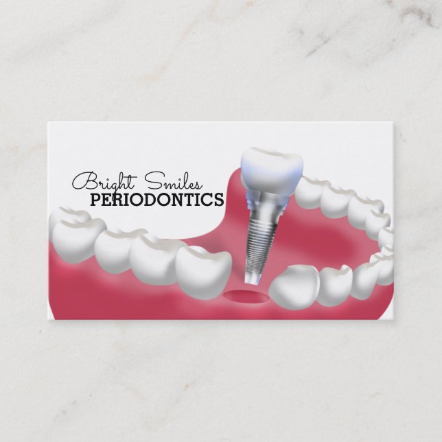 Affärskortet Periodontist dentist Visitkort (Framsida)