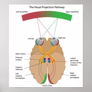 Affischen för visuellt hjälpmedelprojektionsbana poster