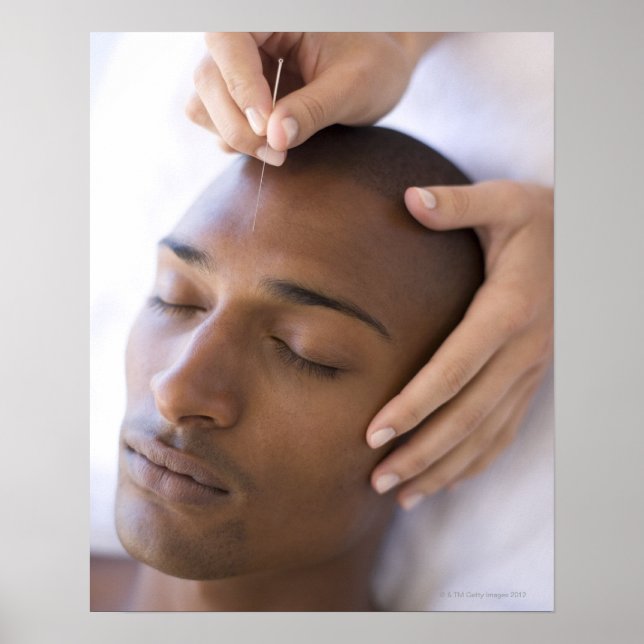 Akupunktur Acupuncturist som infogar en nål Poster (Framsidan)