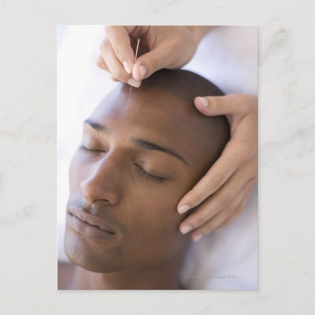 Akupunktur. Acupuncturist som sätter in en nål Vykort (Framsida)