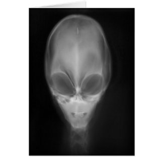 Alien Skull-röntgen Hälsningskort
