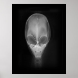 Alien Skull-röntgen Poster