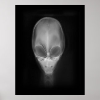 Alien Skull-röntgen Poster