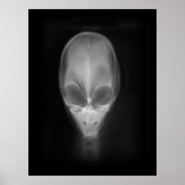 Alien Skull-röntgen Poster (Framsidan)