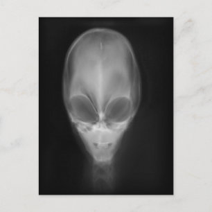 Alien Skull-röntgen Vykort