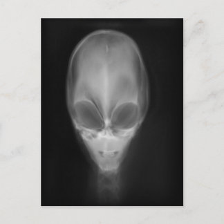 Alien Skull-röntgen Vykort
