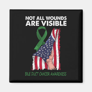 Alla sår är inte synliga vid cancer i bileuccus. magnet