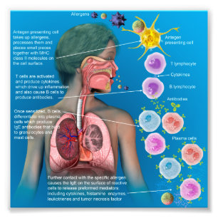 Allergier: IgE upphetsa svarsaffisch Fototryck