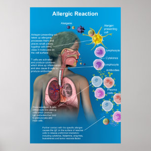 Allergiska reaktioner poster