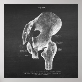 Anatomi Art nr 4 Hip Joint Poster