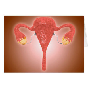 Anatomi av den kvinnliga livmodern med Ovaries Hälsningskort