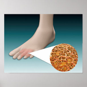 Anatomi av fotsvampen med mikroskopisk närbild poster