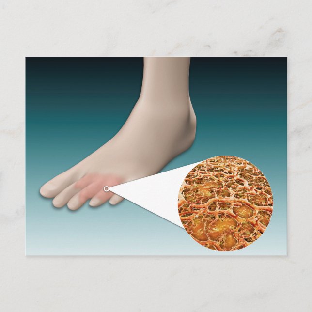 Anatomi hos dimsvampar med mikroskopisk närbild vykort (Framsida)