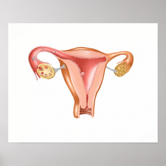 Anatomi hos kvinnligt Uterus 1 Poster (Framsidan)