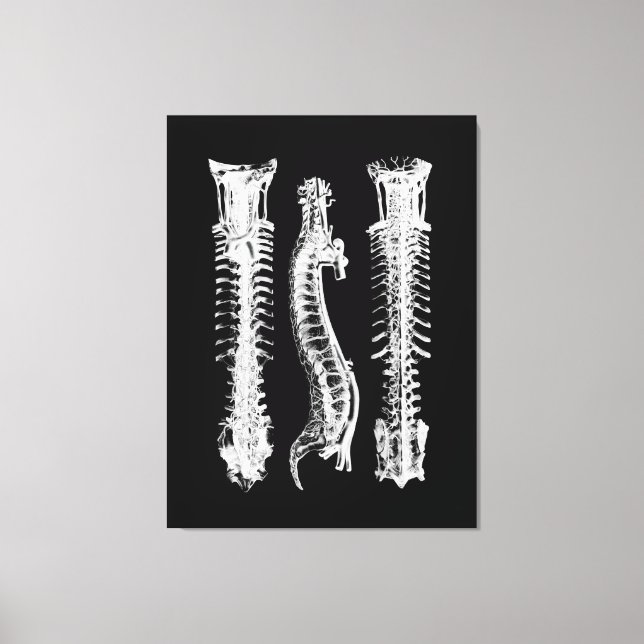 Anatomi Human Spine Large Canvas Art (Framsida)