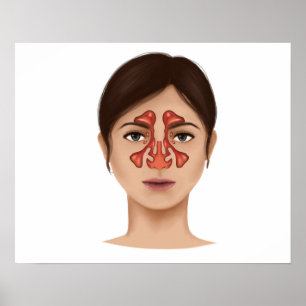 Anatomi i Nasal Sinuses Poster