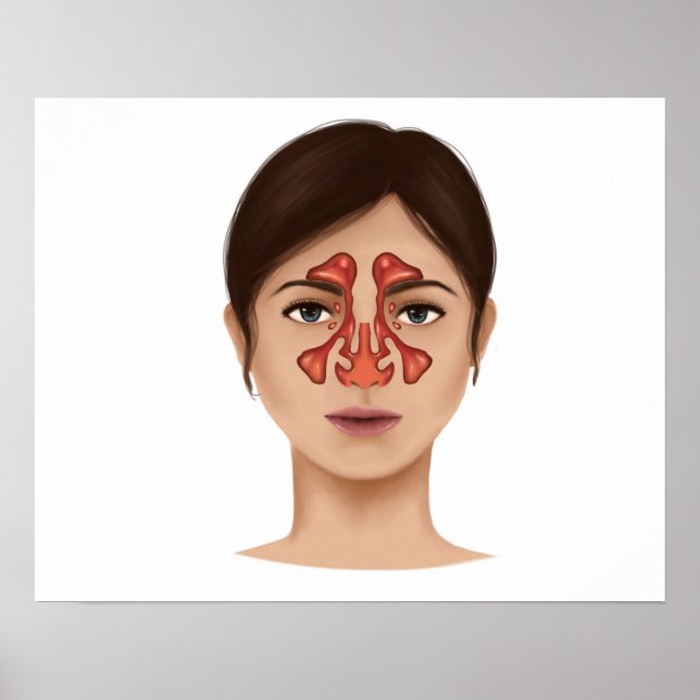 Anatomi i Nasal Sinuses Poster (Framsidan)