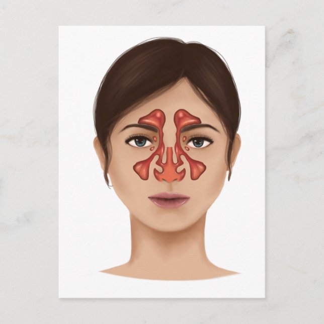 Anatomi i Nasal Sinuses Vykort (Framsida)