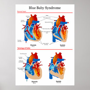 Anatomical hjärtadiagram av baby med poster