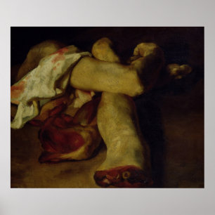Anatomical lappar poster