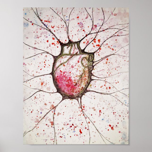 Anatomiskt hjärtbesvär - Poster 8,5 x 11 (Framsidan)