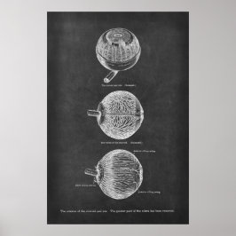 Anatomiskt material från Öga i Choroid & Iris Poster
