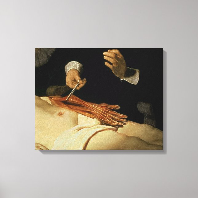 Anatomy Lesson of Dr Nicolaes Tulp, 1632 Canvastryck (Framsida)