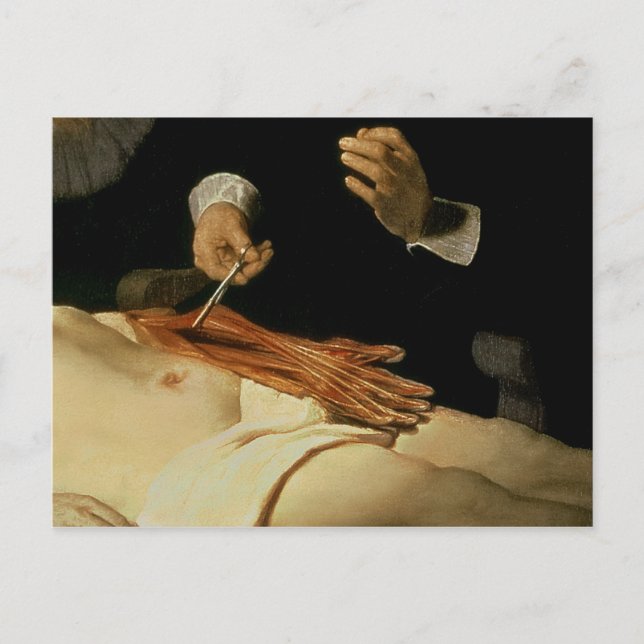 Anatomy Lesson of Dr Nicolaes Tulp, 1632 Vykort (Framsida)